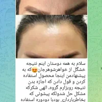 جادوی جوانسازی پوست خانم های زنجانی