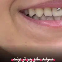 پیرسینگ ساماندهی