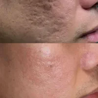 گیاهی روشن کننده ضدلک ۳ روز|خدمات آرایشگری و زیبایی|ایرانشهر, |دیوار
