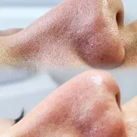 رنگ مو فیشیال دکلره موخوره گیری تخصصی