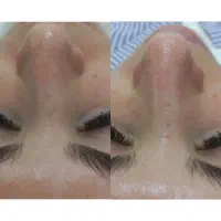 پاکسازی و فیشیال تخصصی پوست
