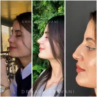 فرصت استثنایی عیدانه