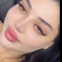 آموزش تزریق ژل و بوتاکس|خدمات آرایشگری و زیبایی|یاسوج, |دیوار