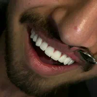 خدمات دندانپزشکی (نرخ قدیم)
