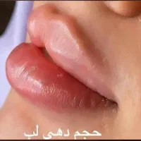 کلینیک زیبایی لریس|خدمات آرایشگری و زیبایی|تهران, تهرانپارس شرقی|دیوار