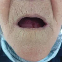 لابراتوار دندان سازی سلامت|خدمات آرایشگری و زیبایی|نیشابور, شریعتی|دیوار