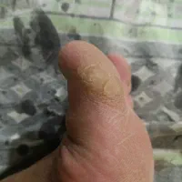 از بین بردن ترک پاشنه پا در یک جلسه  تضمینی|خدمات آرایشگری و زیبایی|شیراز, ماه فیروزان|دیوار