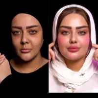 جشنواره فوق تخفیفی تزریق چربی و زیبایی رویان