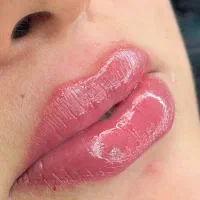 اف یلدایی خدمات ژل و بوتاکس|خدمات آرایشگری و زیبایی|آبادان, |دیوار