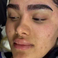 بلفاروپلاستی ،سانترال،دایرکت ابرو،کاشت vipجشنواره|خدمات آرایشگری و زیبایی|تهران, تجریش|دیوار