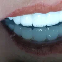 دندانپزشکی بیمه تامین اجتماعی کمیته امدادوبهزیستی|خدمات آرایشگری و زیبایی|نورآباد, |دیوار