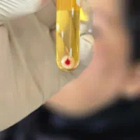 مرکز پی آر پی ،مزوتراپی ،سلول درمانی ،زانو،بوتاکس|خدمات آرایشگری و زیبایی|کرج, عظیمیه|دیوار