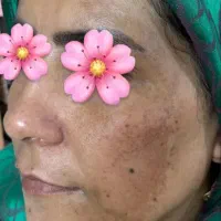 کرم ژل رویال بهترین ضدلک|آرایشی، بهداشتی، درمانی|قم, امامزاده ابراهیم|دیوار