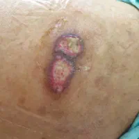 پرستار زخم دیابتی بستر بخیه سوند درمنزل سابقه بالا|خدمات آرایشگری و زیبایی|تهران, صادقیه|دیوار