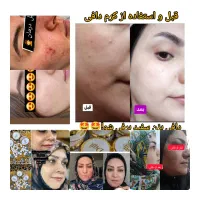 کرم سفید کننده صورت  بدن 10درجه سفیدی بدون بازگشت|آرایشی، بهداشتی، درمانی|زابل, |دیوار