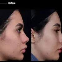 جشنواره تخفیفات تابستانه جراحی بینی،صورت،پیکرتراشی|خدمات آرایشگری و زیبایی|کرج, مهرویلا جنوبی|دیوار
