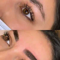 مدل برای میکروبلیدینگ ابرو فیبروز