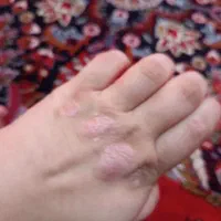 سبوره و پستوزیاس