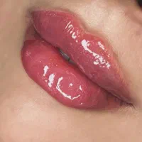 تزریق ژل و بوتاکس و فیلر طبیعی