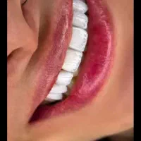 تخفیف خدمات دندان پزشکی