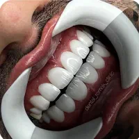 تراکت پخش کن