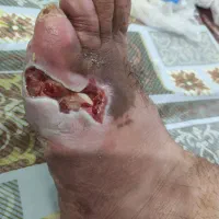 پی ار پی،جشنواره سلول بنیادی جفت جنین،ترمیم زخم|خدمات آرایشگری و زیبایی|قم, دورشهر|دیوار