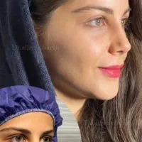 فرصت طلایی  عمل جراحی بینی در کرج