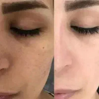 معجزه کرم بیوممتیک اصل( 50%تخفیف ویژه )+ هدیه‌ویژه