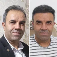 کلینیک تخصصی پوست، مو و زیبایی پارسامهر|خدمات آرایشگری و زیبایی|تهران, امیریه|دیوار