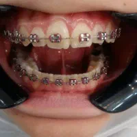 اورتودنسی طرح همدلی