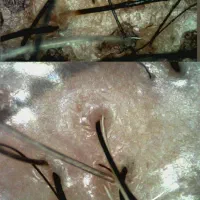 اسکالپ فردائم کراتین بافت مو