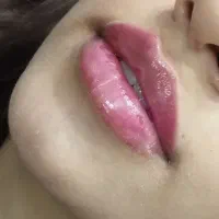 ژل ـ لب ـ گونه و... بوتاکس. آنزیم|خدمات آرایشگری و زیبایی|قم, تولید دارو و یخچال|دیوار