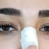 مژه هیدن