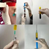 تخفیف ویژه پی آر پی|آرایشی، بهداشتی، درمانی|بهبهان, |دیوار