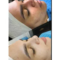 فیشیال پوست