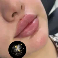 تزریق ژل فیلر بوتاکس تضمینی پرسینگ لیفت ابرو و مژه