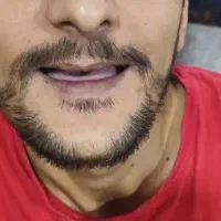 ساخت دندان مصنوعی کامل و تکه ای ضمانتی|آرایشی، بهداشتی، درمانی|مرودشت, بیست متری بیمارستان|دیوار