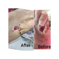 کارشناس زخم/خدمات تخصصی پرستاری در منزل|خدمات آرایشگری و زیبایی|اصفهان, شهید رجایی|دیوار