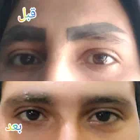 اموزش و خدمات ریموو تک جلسه ای با ض.م.ا.ن.ت|خدمات آرایشگری و زیبایی|کرمان, |دیوار