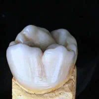 نیروی آقا جهت سنگ فریم لابراتوار دندانسازی