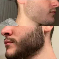 این آخرین روشیه که امتحان میکنی