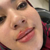 ژل و بوتاکس|خدمات آرایشگری و زیبایی|مشهد, ایثار|دیوار