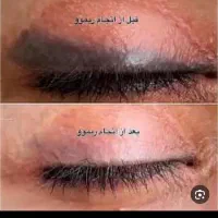 ریمو تتو با ۵۰درصد تخفیف با دستگاه کیوسویچ