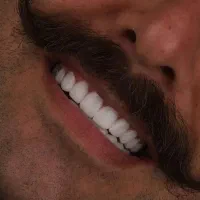 فستیوال اقساطی دندان پزشکی خدمات دندانپزشکی|خدمات آرایشگری و زیبایی|اصفهان, دشتستان|دیوار