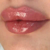فیلر ،بوتاکس ، مزو ، همراه با تخفیف تکرار نشدنی