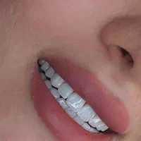 دندان کامپوزیت دندانپزشکی باهوش مصنوعی|خدمات آرایشگری و زیبایی|مشهد, دانشجو|دیوار