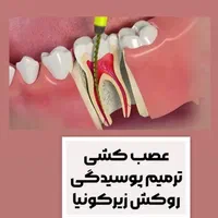 دندانپزشکی ((اقساط)) کامپوزیتـ ایمپلنت عصب کشی|خدمات آرایشگری و زیبایی|قدس, شهر‌قدس|دیوار