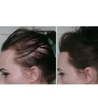 ریزش مو کم من|آرایشی، بهداشتی، درمانی|قم, صفاشهر|دیوار