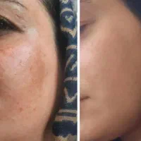 نمایندگی رسمی کرم تیرگی گاتیو
