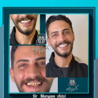 عصب کشی تخصصی دندان در دندانپزشکی باسابقه و مجرب